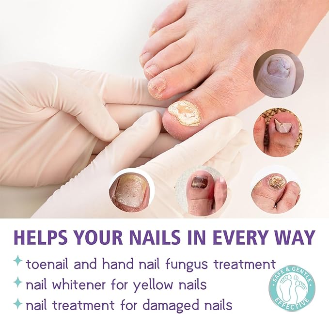 Jaysuin - Nail Fungus Spray (Original)